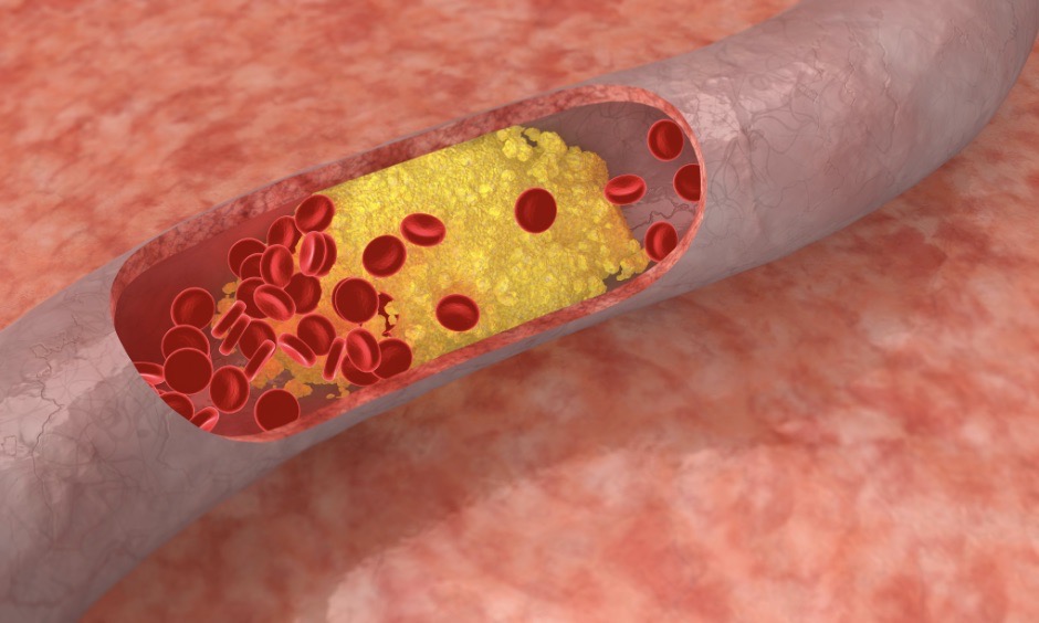 Cholesterol dobry czy zły?